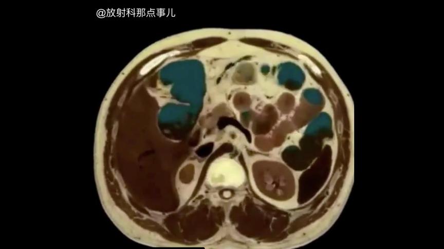 [图]从头到腿断层解剖图，这么多解剖结构你都能记住吗？