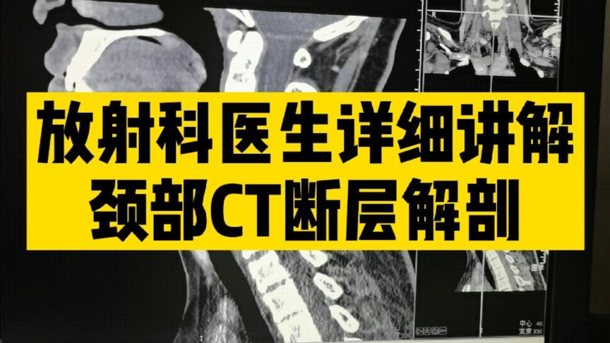 [图]放射医生实例逐层讲解颈部CT断层解剖，适合影像初学者和临床医生