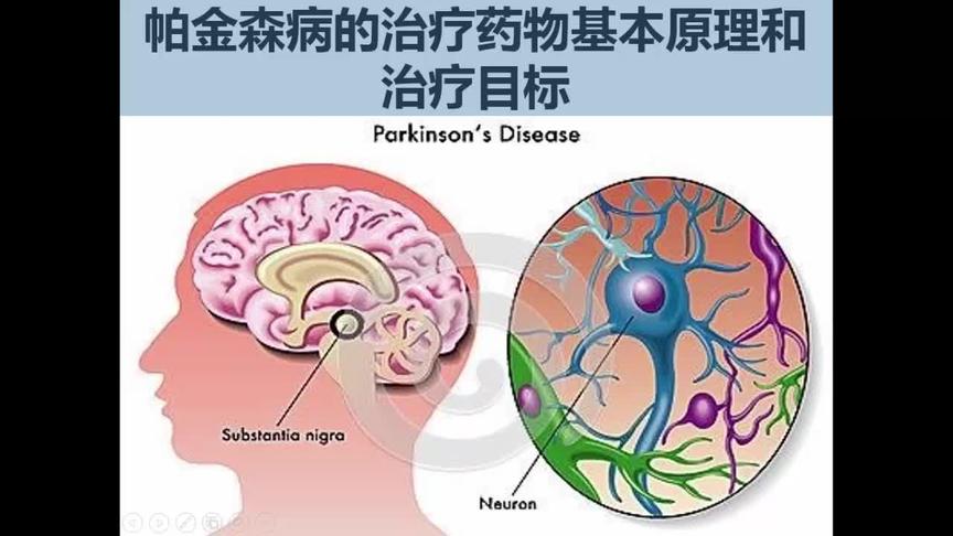 [图]8帕金森病的治疗药物基本原理和治疗目标