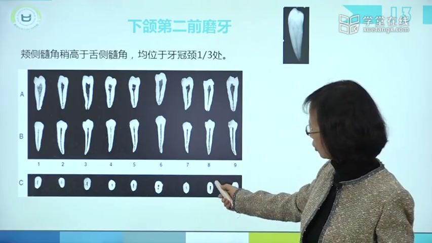 [图]【口腔解剖】第二章 牙体解剖生理-牙髓腔解剖-前磨牙