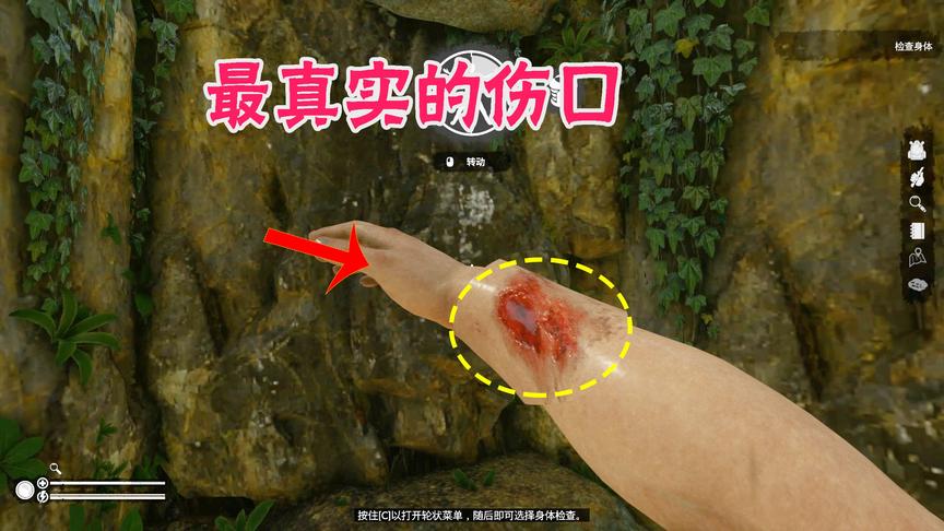 绿色地狱01：这是最硬核的生存游戏，这伤口看着都疼