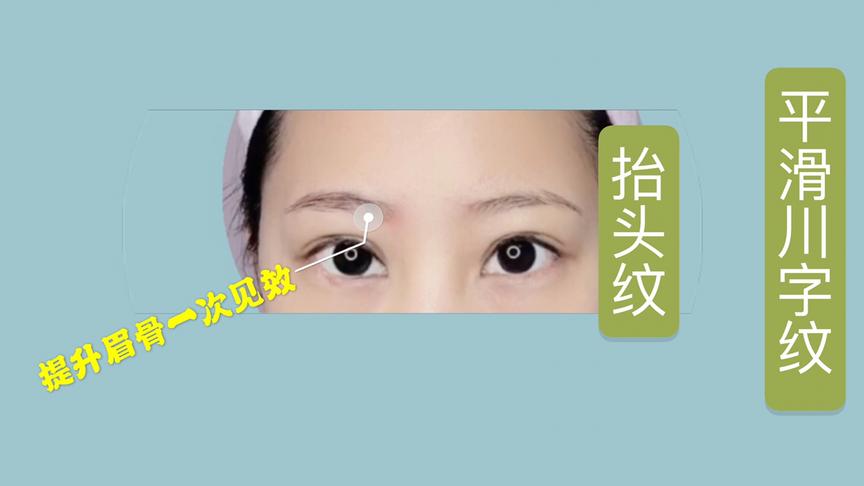 按摩眉骨有什么好处 西瓜视频