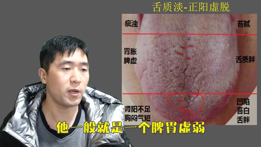 舌根苔厚腻是什么原因 西瓜视频