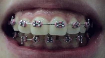 牙齿凸起的图片 西瓜视频